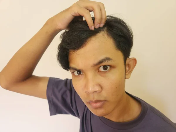 アジアの男の衝撃的な顔取得はげと失われた髪で隔離された白い背景 — ストック写真