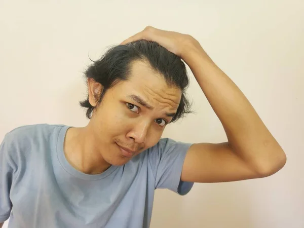Вражене Обличчя Азіатського Чоловіка Лисіє Втрачає Волосся Ізольованому Білому Фоні — стокове фото