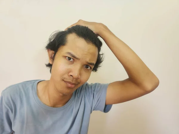 Schockiertes Gesicht Eines Asiatischen Mannes Mit Glatze Und Verlorenen Haaren — Stockfoto