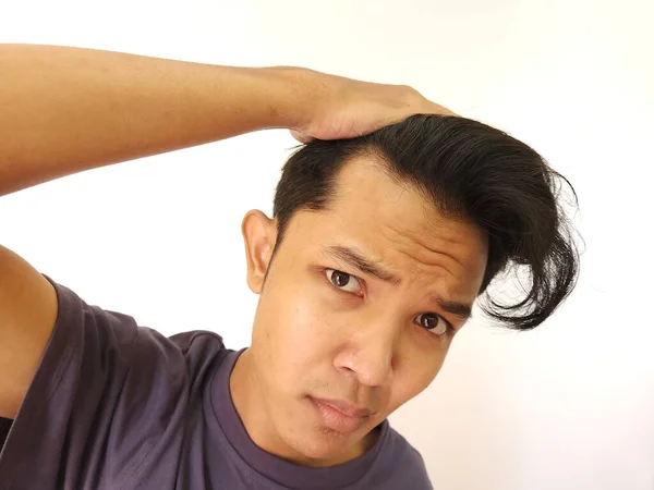 Σοκαρισμένο Πρόσωπο Ενός Ασιάτη Που Καραφλιάζει Και Χάνει Μαλλιά Του — Φωτογραφία Αρχείου