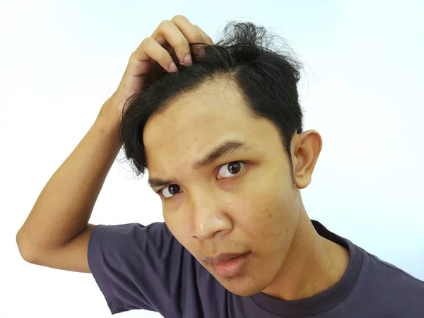 Шокированное Лицо Азиатского Мужчины Лысеющего Потерянные Волосы Изолированном Белом Фоне — стоковое фото