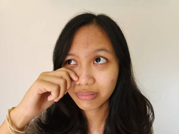 Ásia Mulher Preocupado Com Acne Ela Testa Isolado Branco — Fotografia de Stock