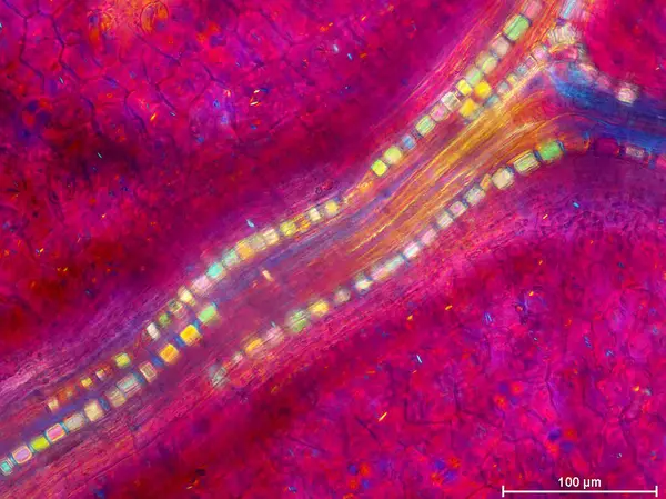 Tinospora yaprağındaki damar demetleri boyunca dizilmiş prizma kristallerinin polarize ışık mikrografı