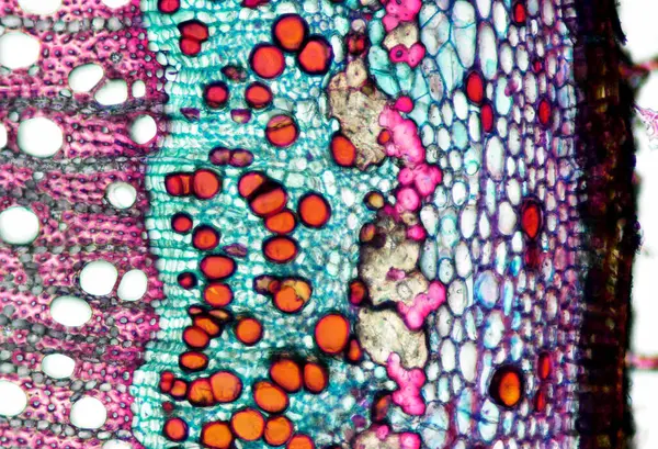 Fadogia Antlaşmacılarının mikrografı, fenolik maddelerin çoğunlukla phloem 'de turuncu olduğunu gösteren çapraz kesitte yer almaktadır.