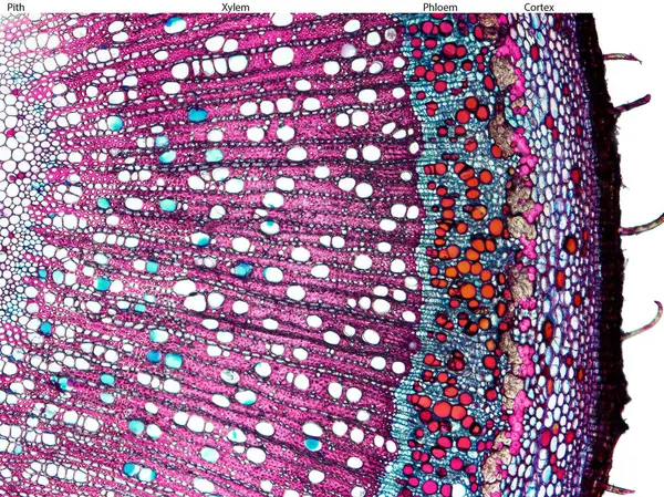 Fadogia Antlaşmacılarının mikrografı, fenolik maddelerin çoğunlukla phloem 'de turuncu olduğunu gösteren çapraz kesitte yer almaktadır.