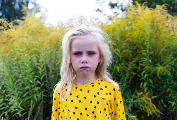 sad child looking sick with red watery eyes and runny nose caused by seasonal allergy on ragweed or ambrosia. blond girl in yellow jumper looking at camera, flowering ragweed field on background