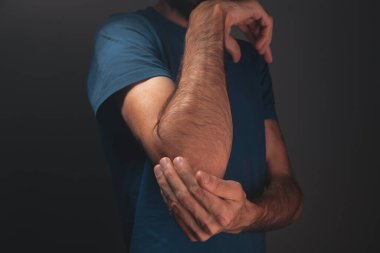 Dirsek ağrısı olan adam. .