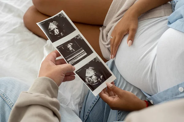 Pareja Embarazada Multiétnica Viendo Imagen Ultrasonido Casa Primer Plano Sintiéndose —  Fotos de Stock