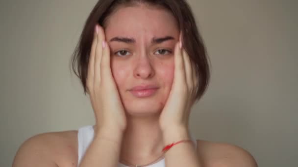 Jovem Preocupada Causada Por Inflamação Acne Cicatriz Acne Ocorrem Seu — Vídeo de Stock