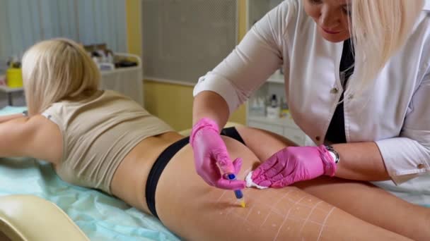 Kosmetolog Nastiňuje Body Pro Injekce Použitím Markeru Pro Hubnutí Liposukce — Stock video