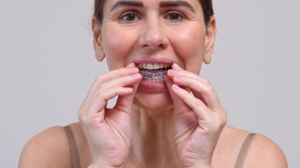 Close Middle Aged Woman Putting Transparent Aligners Upper Jaw Dental — Stock Video