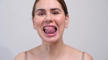 Yakın plan orta yaşlı kadın üst çene diş sağlığı ve diş hekimliği ortodonti kavramına şeffaf hizalayıcılar takıyor
