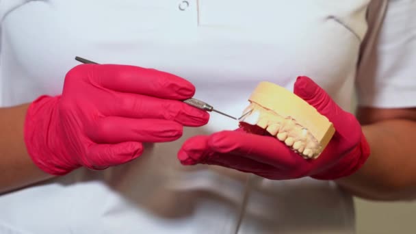 医療用手袋のクローズアップ歯科医の手は 患者への治療を記述する プラグを使用して石膏人間の顎のレイアウトを保持します 口腔衛生歯科矯正治療 高品質4K映像 — ストック動画