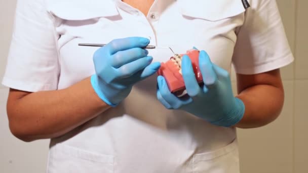 Zbliżenie Dłonie Dentysty Rękawicach Medycznych Trzymać Gipsu Ludzkiego Układu Szczęki — Wideo stockowe