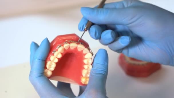 Las Manos Del Dentista Cerca Guantes Médicos Sostienen Diseño Mandíbula — Vídeos de Stock