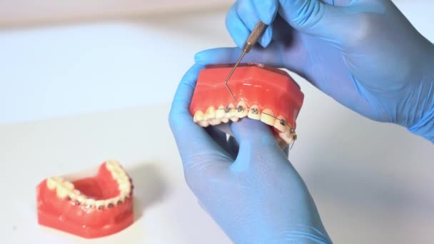 Close Dentist Hands Medical Gloves Hold Plaster Human Jaw Layout — Stock Video