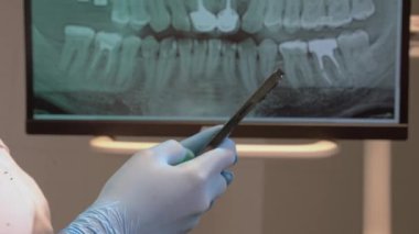 Kapalı diş hekimi steril eldiven, yeşil ekran cep telefonunu diş hekimliği ofisinde monitörde diş röntgeninin üzerinde tutuyor. Ortodontist kaydırma akıllı telefon kroma anahtar model şablonu dişler için görüntüde.