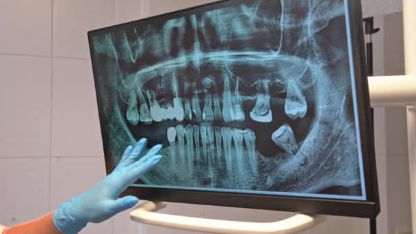 歯医者は歯の口腔X線をモニター上で調査し 歯科事務所で患者に治療を説明します 口腔衛生歯科治療 健康歯のケアの検査 — ストック動画
