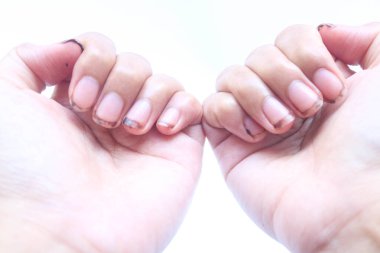 Avuç içini kapayarak, kesilmesi gereken uzun kirli tırnaklar ve beyaz arka planda izole edilmiş manikür görünüyor.