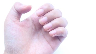 Avuç içini kapayarak, kesilmesi gereken uzun kirli tırnaklar ve beyaz arka planda izole edilmiş manikür görünüyor.