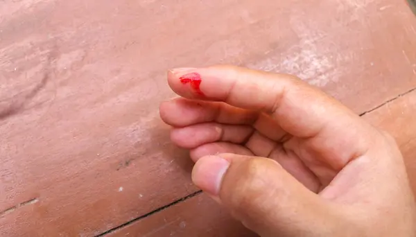 Parmağında bıçak yarasıyla yaralanmış. İnsan el işaret parmağını kapat. Yaralı ve parlak kırmızı kanla kanaması var..