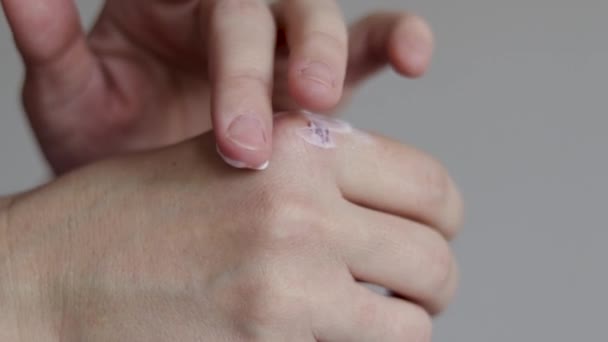 Woman Apply Cream Wound Hit Hand Fist Close Slow Motion — Αρχείο Βίντεο