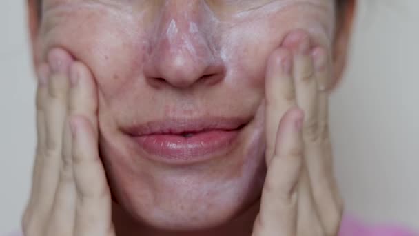 Frau Verwenden Silikon Vakuum Gesichtstasse Oder Handfinger Für Gesicht Falten — Stockvideo