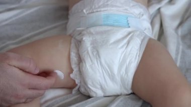 adorable cute baby back butt with smiley face emoticon or heart shape from body diaper cream white lotion.toddler infant lies on belly tummy covered partially with blanket.red skin soft delicate care