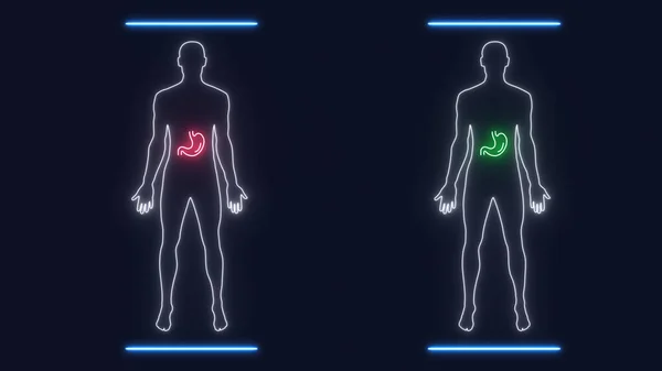 Işını Gastro Organlarıyla Insan Erkek Silueti Taraması Arayüz Sınavı Sindirim — Stok fotoğraf