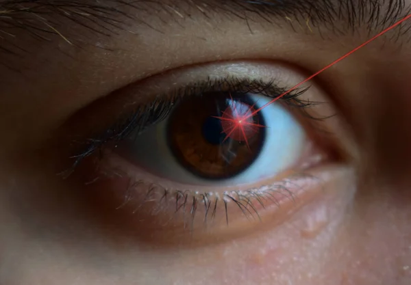 close up surgery of a female eye with a laser beam