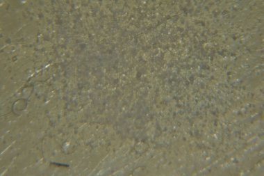 Mutfak tuz kristallerini kapat 