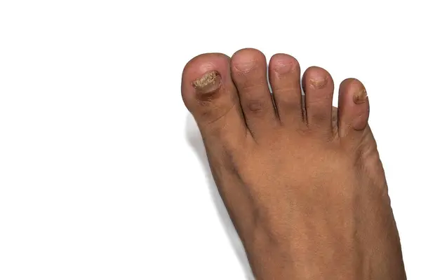 Beyaz arkaplanı olan insan ayağını kapat