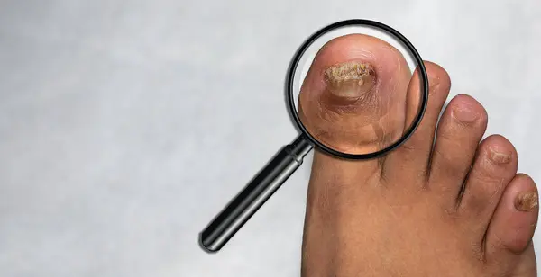 Büyüteçle bir adamın ayağı bardakta