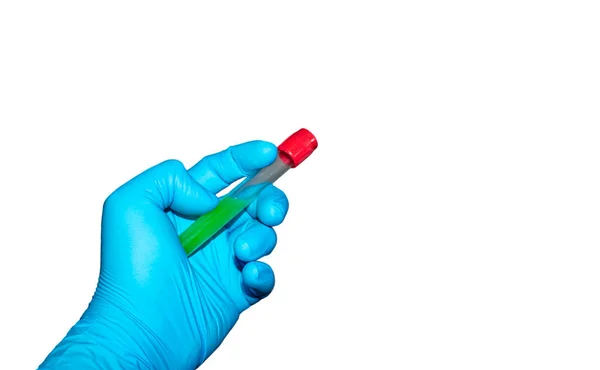 Beyaz arka planda kan testi tüpü olan mavi tıbbi eldivenler.