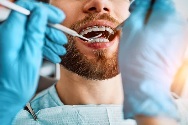Immagine Ritagliata Controllare Denti Paziente Con Apparecchio Clinica Dentale Cure — Foto Stock