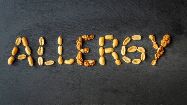 Fındık alerjisi. ALLERGY kelimesi çeşitli fındıklardan oluşur. Sağlık kavramı. Bağışıklık sistemi reaksiyonu, anaflaktik şok. Fıstık, alerji semptomları ve teşhisi. Boşluğu kopyala, kapat, düzleştir