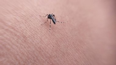 Sivrisinek ısırığıyla bulaşan tehlikeli sıtma. Leishmaniasis, Ensefalit, Ateş, Dang, Sıtma, Sivrisinekler, Parazitler, Makro Böcekler.