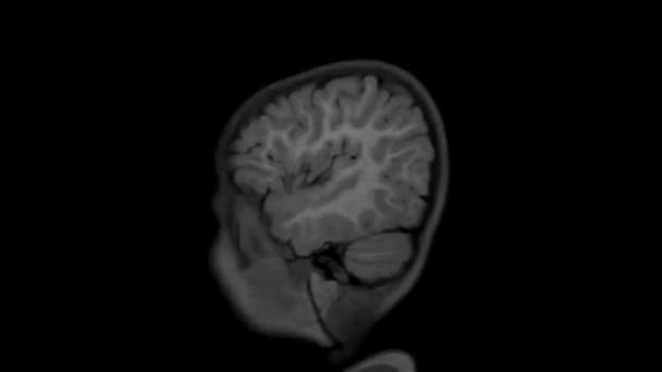 Anatomia Cérebro Humano — Vídeo de Stock