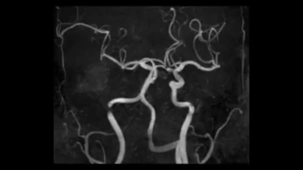 Latar Belakang Abstrak Dengan Otak Manusia Dan Otak Manusia — Stok Video