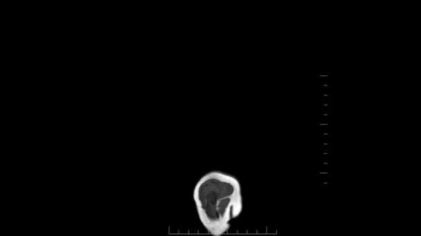 Resonancia Magnética Escaneo Corporal Ser Humano — Vídeo de stock
