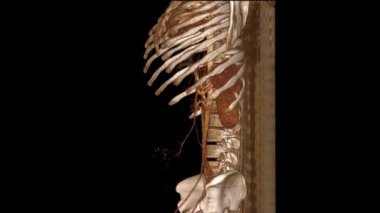 Monitörde Dönen Resimle Omurga 'nın 3B CT Taraması