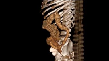 Gerçekçi 3D Erkek Gövdesi Tomografisi: Tıbbi Animasyon İçin Detaylı Anatomik Yeniden Yapılandırma