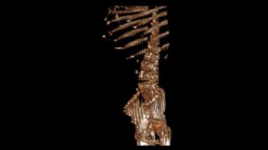 Hassas Görüntü için 3B İnce CT Tarama Görünümü Geliştirilmiş Ayrıntılı Görünüm