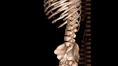 HRCT şakak tomografisi pozisyonu