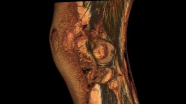 Sol diz MRI taraması 3D model