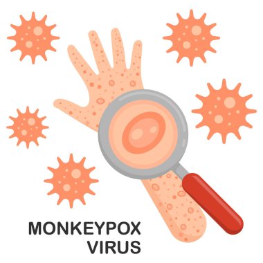 Maymun çiçeği virüsü kol kola. Maymun çiçeği virüsü salgını, kabarcıklar ve boş vakitler gibi bulaşıcı bir enfeksiyon olarak görülür. Vektör çizimi. Eps 10.