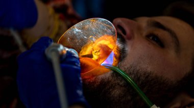 Diş çürüğünün önlenmesi. Diş tedavisi sırasında dişçi koltuğunda oturan adam. Gülümse makyaj..