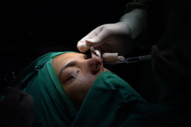 Burun estetiği ameliyatı, kadın hastada burun şeklindeki kusurlar. Estetik cerrahi burun estetiğine cerrahi müdahale