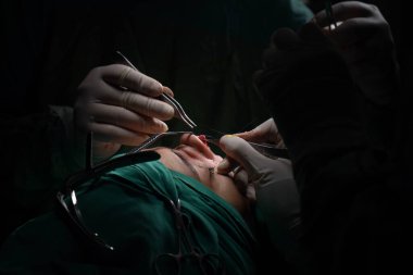 Burun estetiği ameliyatı, kadın hastada burun şeklindeki kusurlar. Estetik cerrahi burun estetiğine cerrahi müdahale