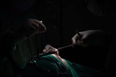 Burun estetiği ameliyatı, kadın hastada burun şeklindeki kusurlar. Estetik cerrahi burun estetiğine cerrahi müdahale